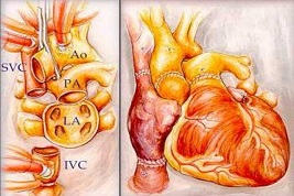 yǰУ۔[ [ˡ`꠳ɹekKI֪RόW